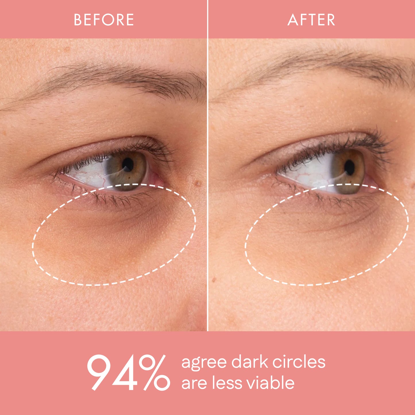 Zylura™ Hydrating Eye Brightening Concealer